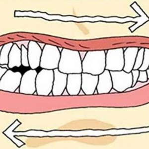夜间磨牙都是蛔虫惹的祸?