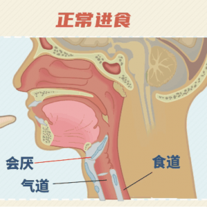 “喉咙痛”可能不是上火，这种病要重视→